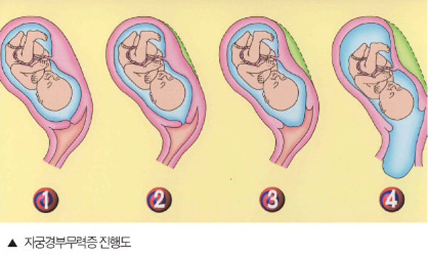 �ڱð�ι����� ���൵