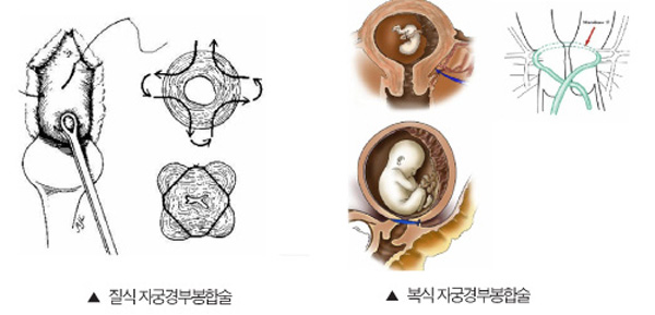 ���� : ���� �ڱð�κ��ռ� / ������ : ���� �ڱð�κ��ռ�