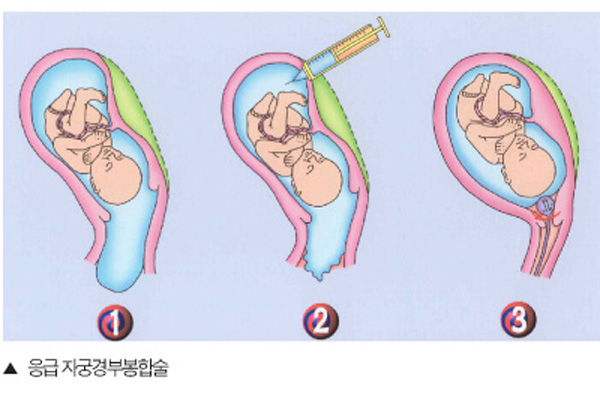 ���� �ڱð�κ��ռ�